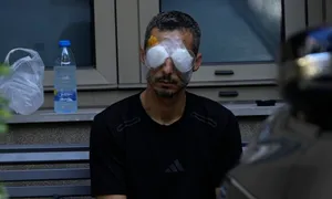 Bác sĩ Lebanon nỗ lực cứu đôi mắt nạn nhân vụ nổ máy nhắn tin